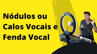 Aula de Canto "Nódulos ou Calos Vocais e Fenda Vocal"