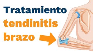 ¿Cómo tratar la TENDINITIS EN EL BRAZO?