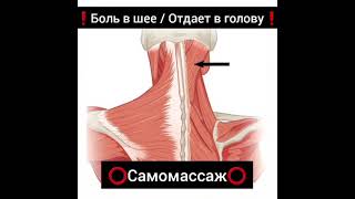 Боль в шее / Отдает в голову / Доктор Артем Пак