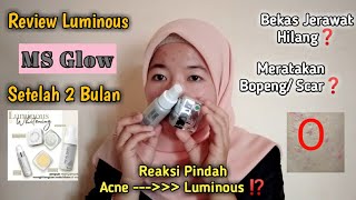 LUMINOUS MS GLOW BISA MERATAKAN SCAR/BOPENG ??? | Review Setelah 2 Bulan Pemakaian Luminous Series