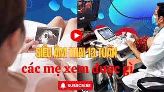 Siêu âm thai 13 tuần các mẹ bầu quan sát được những gì?