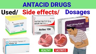 गैस(Gas) की समस्या को ठीक करने के लिए सबसे ज्यादा इस्तेमाल की जाने वाली दवाएं// Acidity Gastritis