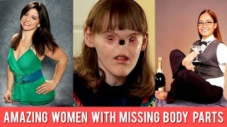 8 Amazing Women With Missing Body Parts