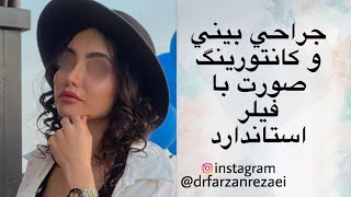 نمونه ای از جراحی بینی  به همراه كانتورينگ صورت