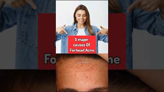 Causes Of Forhead Acne❓#shorts #forheadacne #acnescars #trendingshorts #viralshorts #subscribe