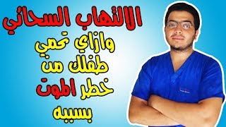 اعرف كل حاجة عن الالتهاب السحائي ( اعراض-ووقاية- ومضاعفات)