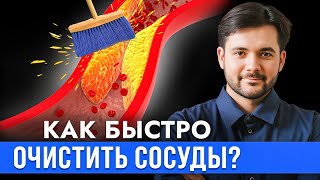 Можно Ли Очистить Сосуды в Домашних Условиях? Атеросклезора Больше НЕ БУДЕТ!