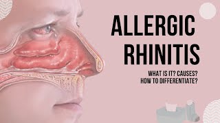 Allergic Rhinitis | Definition, Causes, and Differentiation