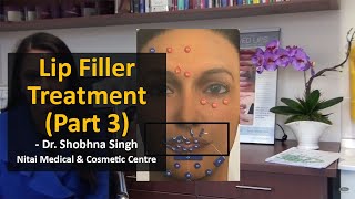 Lip Filler Treatments by Dr Shobhna Singh (Part 3) - Nitai Medical & Cosmetic Centre