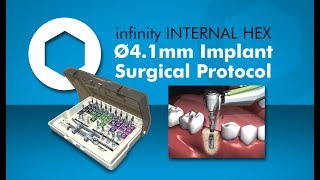 infinity INTERNAL HEX 4.1mm Implant Surgical Protocol