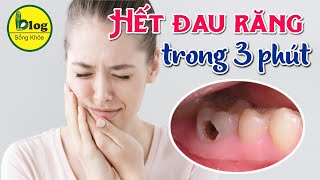 10 cách trị đau răng cấp tốc tại nhà an toàn mà hiệu quả