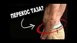 СИДЯЧИЙ ОБРАЗ ЖИЗНИ? Перекос(смещение) таза, упражнения для лечения и профилактики