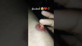 Accident 😭💔🥀 #viral #youtubegrowth #ytshorts #کل #موت #kullu #account