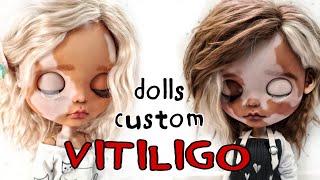 Doll's custom Vitiligo / Процесс создания куколки Блайз с витилиго