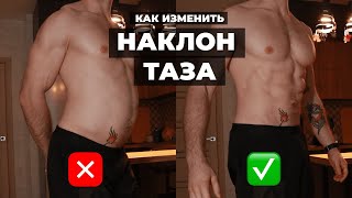 Фиксация переднего наклона таза (ПОЛНАЯ ПРОЦЕДУРА)