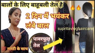 😱 डॉक्टर भी हैरान है इस तेल को लगाकर 10 गुणा बालों की लंबाई बढ़ती है 💯 best तेल | bal babhane ka oil