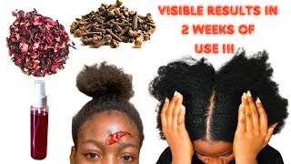 Do Not Wash Out! USE CLOVE AND HIBISCUS SPRAY FOR 2 WEEKS & YOUR HAIR WON’T STOP GROWING