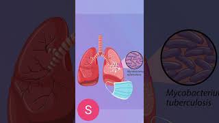 Radiology #5 #healthcare #radiology #science #casestudy