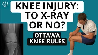 Ottawa Knee Rules: When Should You Get a Knee X-ray? | Aleks Physio