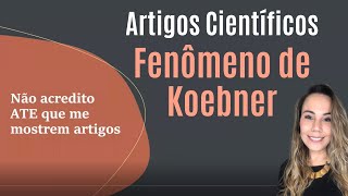 NÃO ACREDITO | Fenômeno de Koebner