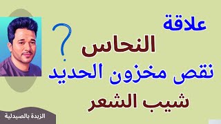 ظهور شيب الشعر المبكر \ النقص المستر لمخزون الحديد \ النحاس ومالم تعلمه من قبل