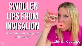 CAN YOU GET SWOLLEN LIPS FROM INVISALIGN? 2024 | It's rare, but it can happen. Learn 3 reasons why!