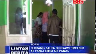 Balita Tercebur Panci Berisi Air Panas di ngawi