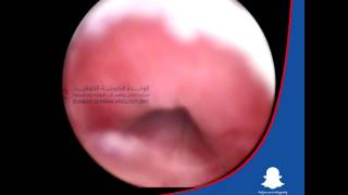 Urethroscopy for Male - Dr. Ali Mehdi Zadeh Consultant Urologist German Urology Doctor