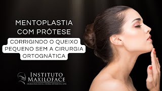 Mentoplastia com prótese - Como corrigir o queixo pequeno sem a cirurgia?   Instituto Maxiloface