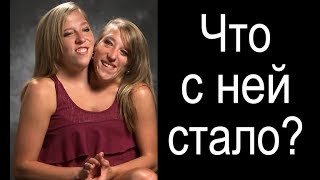 А У НАС БЫ ЕЁ СРАЗУ ЗАЛОШИЛИ. двухголовая девушка