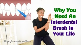 Why you Need To Consider Using An Interdental Brush