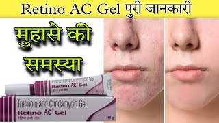 Retino AC Gel | Tretinoin & Clindamycin gel | Uses | Dose | Side effects | Precautions | Price