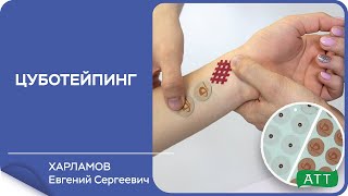 Цуботейпинг. Магнитотейпинг. Тейпирование с магнитами.