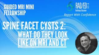 MRI Online Review Learn MRI Spine Radiology : MRI and CT Spine Facet Cysts What to look for