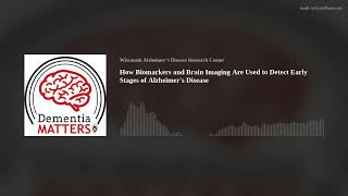 How Biomarkers and Brain Imaging Are Used to Detect Early Stages of Alzheimer’s Disease | Ep. 19