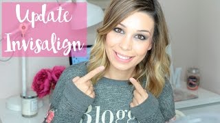 Invisalign Update! III | Monica TBM