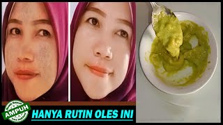 Cara Menghilangkan Flek Hitam  Serta Memutihkan Wajah Hingga Glowing