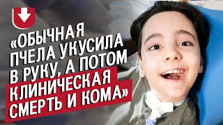 У сына была клиническая смерть после укуса пчелы: Аня | Быть мамой