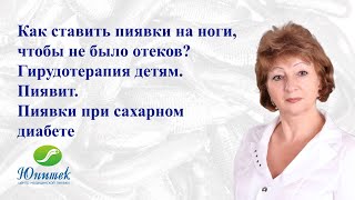 Семинар с Дугенец Галиной Васильевной. Как ставить пиявки на ноги, чтобы не было отеков?