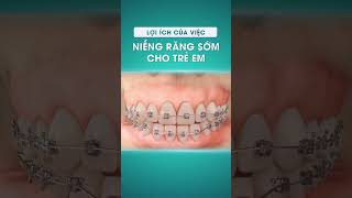 Lợi ích của việc niềng răng sớm! #dental #nhakhoa