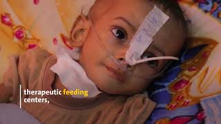 WHO Yemen: Millions of malnourished children trapped in a forgotten crisis in Yemen