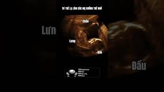 Khó thế mà bé cũng làm được #sieuamthai#ultrasound#mebau#pregnancy#baby#beyeu#babau#shortsvideo#boy