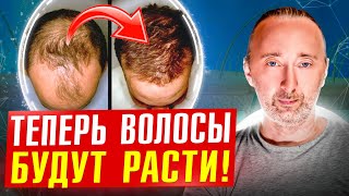 Как реально отрастить волосы, убрать лысину и даже седину?