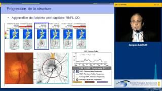 PIO et progression - Le GPAO progresse ! (Jacques Laloum)