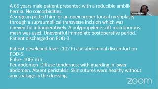 Virtual Ward Round: Entero-Cutaneous Fistula