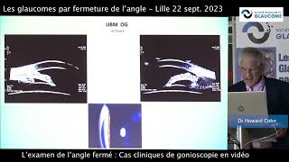 Cas cliniques de gonioscopie en vidéo Dr Howard Cohn