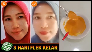 CARA MENGHILANGKAN FLEK HITAM PALING CEPAT & AMPUH!