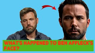 Did Ben Affleck Really Get Cosmetic Surgery? See His First Appearance Post-Rumors!