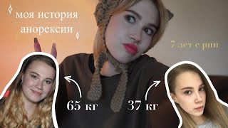 Моя история анорексии/похудение до 37 кг/7 лет с рпп/вся правда