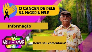 O Câncer de pele na Própria pele - Modulo 2